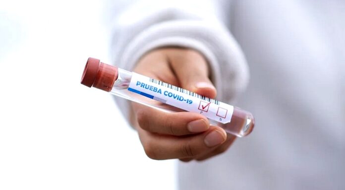 I dobrovolné covid testy u zaměstnanců jsou daňově uznatelné covid testy