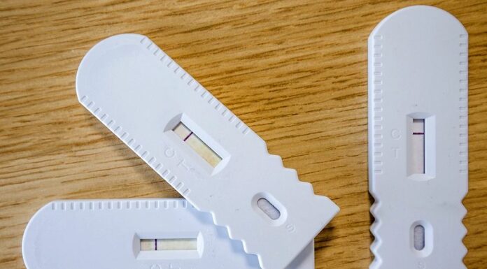 Rozdíly v cenách za AG test pro stát a firmy jsou alarmující AG_test